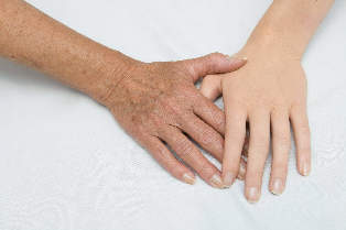 Verjüngung der Haut der Hände