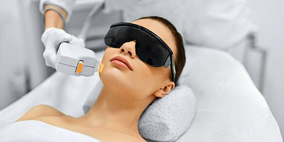 Laserverfahren zur Hautverjüngung